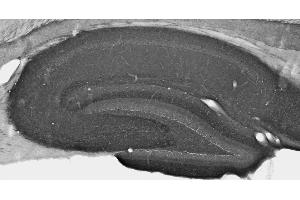 Adult rat hippocampus immunohistochemistry under standard protocol. (LGI1 抗体  (AA 37-113))