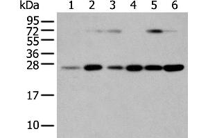 Western Blotting (WB) image for anti-Synaptosomal-Associated Protein, 23kDa (SNAP23) antibody (ABIN2424185) (SNAP23 抗体)