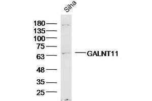 Siha Cell lysates probed with GALNT11/GalNAc-T11 Polyclonal Antibody, unconjugated  at 1:300 overnight at 4°C followed by a conjugated secondary antibody for 60 minutes at 37°C. (GALNT11 抗体  (AA 401-500))