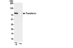 Western Blotting (WB) image for anti-Transferrin (TF) antibody (ABIN7449492)
