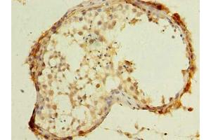 Immunohistochemistry of paraffin-embedded human testis tissue using ABIN7174599 at dilution of 1:100 (UBXN6 抗体  (AA 1-388))