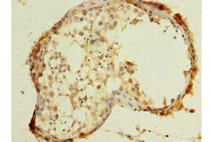 Immunohistochemistry of paraffin-embedded human testis tissue using ABIN7174599 at dilution of 1:100