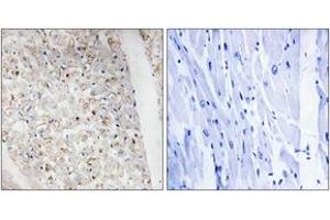 Immunohistochemistry analysis of paraffin-embedded human heart, using PKD1/2/3/PKC mu (Phospho-Ser738+Ser742) Antibody. (PKD1/2/3/PKC mu (AA 706-755), (pSer738) 抗体)