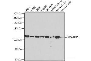 Western blot analysis of extracts of various cell lines using SMARCA5 Polyclonal Antibody at dilution of 1:1000. (SMARCA5 抗体)