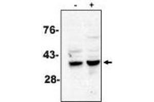 Western blot analysis using caspase-7 antibody on MCF-7 cells treated with thapsigargin for 48 hours which are negative (-) and positive (+) for caspase-3. (Caspase 7 抗体)