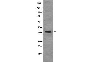 Western blot analysis of NEUROD6 expression in 293T whole cell lysate ,The lane on the left is treated with the antigen-specific peptide. (NEUROD6 抗体  (Internal Region))
