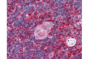 Anti-ARPC1B / p41-ARC antibody IHC of human thymus. (ARPC1B 抗体  (AA 2-14))