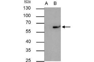 IP Image RAP1 antibody immunoprecipitates RAP1 protein in IP experiments. (RAP1 抗体  (Center))