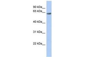 Image no. 1 for anti-TBC1 Domain Family, Member 10B (TBC1D10B) (AA 683-732) antibody (ABIN6742484) (TBC1D10B 抗体  (AA 683-732))