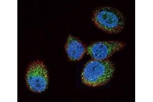 Confocal immunofluorescent analysis of HRAS antibody with MCF-7 cells followed by Alexa Fluor 488-conjugated goat anti-rabbit lgG (green). (HRAS 抗体  (AA 104-128))
