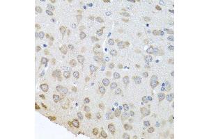 Immunohistochemistry of paraffin-embedded mouse brain using PABPC4 antibody. (PABPC4 抗体  (AA 350-450))
