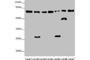 Western blot All lanes: ALB antibody at 2 μg/mL Lane 1: Mouse heart tissue Lane 2: Mouse liver tissue Lane 3: Mouse spleen tissue Lane 4: Mouse lung tissue Lane 5: Mouse kidney tissue Lane 6: Mouse brain tissue Lane 7: Mouse skeletal muscle tissue Secondary Goat polyclonal to rabbit IgG at 1/10000 dilution Predicted band size: 70, 48, 46 kDa Observed band size: 70, 50, 27 kDa (Albumin 抗体  (AA 76-389))