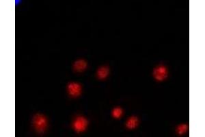 Immunofluorescent analysis of PCGF6 staining in Hela cells. (PCGF6 抗体)