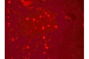 Immunofluorescence of ZGPAT in human brain cells with ZGPAT antibody at 20 ug/mL.
