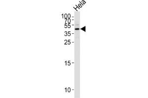 Western Blotting (WB) image for anti-serpin Peptidase Inhibitor, Clade B (Ovalbumin), Member 5 (SERPINB5) antibody (ABIN2996527) (SERPINB5 抗体)