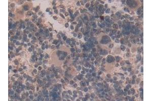 Detection of GLUD1 in Mouse Spleen Tissue using Polyclonal Antibody to Glutamate Dehydrogenase 1 (GLUD1) (GLUD1 抗体  (AA 65-273))