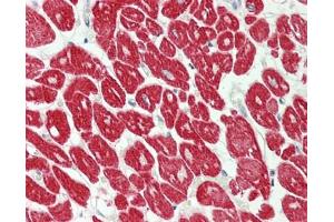 Immunohistochemistry (Paraffin-embedded Sections) (IHC (p)) image for anti-Myosin Light Chain 4, Alkali, Atrial, Embryonic (MYL4) (AA 2-197) antibody (ABIN2743111)