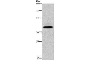 Western blot analysis of Human fetal liver tissue, using SERPINB3 Polyclonal Antibody at dilution of 1:200 (SERPINB3 抗体)