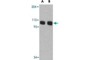 Western blot analysis of AOF2 in P815 cell lysate with AOF2 polyclonal antibody  at (A) 1 and (B) 2 ug/mL . (LSD1 抗体  (N-Term))