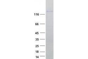 Western Blotting (WB) image for KIAA0226 (KIAA0226) (Transcript Variant 2) protein (Myc-DYKDDDDK Tag) (ABIN2724189)