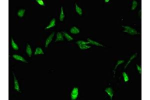 Immunofluorescent analysis of Hela cells using ABIN7170500 at dilution of 1:100 and Alexa Fluor 488-congugated AffiniPure Goat Anti-Rabbit IgG(H+L) (STRBP 抗体  (AA 201-500))