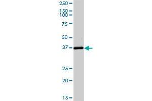 ADH6 MaxPab polyclonal antibody. (ADH6 抗体  (AA 1-295))