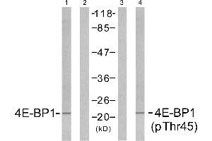Western blot analysis of extracts from MDA435 cells untreated or treated with EGF (200nm, 5mins), using 4E-BP1 (Ab-45) antibody (Linand 2) and 4E-BP1 (phospho-Thr45) antibody (Line 3 and 4). (eIF4EBP1 抗体  (pThr45))