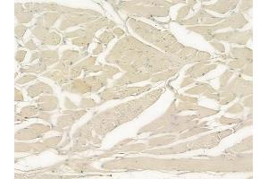 ABIN6258204 and ABIN6273883 at 1/100 staining human tongue carcinoma by IHC-P.