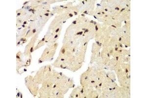 Immunohistochemistry of paraffin-embedded Mouse heart using LIG3 Polyclonal Antibody at dilution of 1:100 (40x lens). (LIG3 抗体)