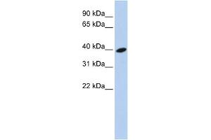WB Suggested Anti-ARL13B Antibody Titration: 0.