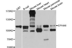 Western blot analysis of extract of various cells, using EPHA8 antibody. (EPH Receptor A8 抗体)