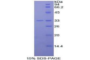 SDS-PAGE analysis of Mouse IL20Ra Protein. (IL20RA 蛋白)
