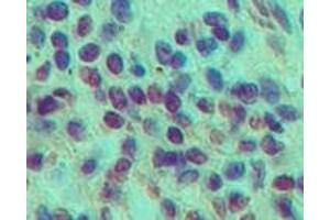 Image no. 1 for anti-C-Type Lectin Domain Family 6, Member A (CLEC6A) (AA 75-125) antibody (ABIN959984)