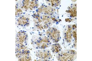 Immunohistochemistry (IHC) image for anti-Somatostatin Receptor 2 (SSTR2) (C-Term) antibody (ABIN3017443)
