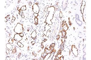 Immunohistochemistry (IHC) image for anti-Complement Fragment C4a (C4a) antibody (ABIN6940808)