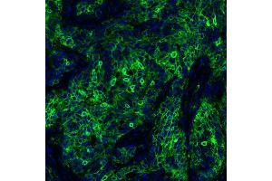Immunofluorescence (IF) image for anti-CD274 (PD-L1) (C-Term) antibody (ABIN7454042)