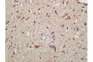 Formalin-fixed and paraffin embedded mouse brain labeled with Rabbit Anti-HMGCR(Ser872) Polyclonal Antibody, Unconjugated  at 1:200 followed by conjugation to the secondary antibody and DAB staining (HMGCR 抗体  (pSer872))