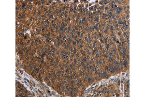 Immunohistochemistry of Human brain  using FCGR3A Polyclonal Antibody at dilution of 1:60 (FCGR3A 抗体)