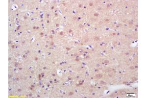 Formalin-fixed and paraffin embedded rat brain labeled with Rabbit Anti phospho-HSF1(Ser326) Polyclonal Antibody, Unconjugated (ABIN703466) at 1:200 followed by conjugation to the secondary antibody and DAB staining (HSF1 抗体  (pSer326))