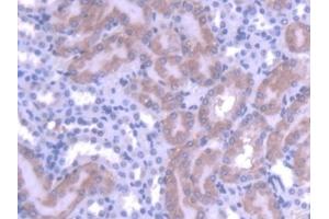 Detection of MTF1 in Mouse Kidney Tissue using Polyclonal Antibody to Metal Regulatory Transcription Factor 1 (MTF1) (MTF1 抗体  (AA 2-139))