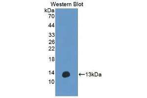 Detection of Recombinant ANO6, Human using Polyclonal Antibody to Anoctamin 6 (ANO6)