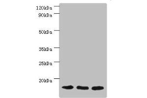 Western blot All lanes: Mitochondrial import receptor subunit TOM20 homolog antibody at 3 μg/mL Lane 1: Mouse brain tissue Lane 2: Hela whole cell lysate Lane 3: Mouse liver tissue Secondary Goat polyclonal to rabbit IgG at 1/10000 dilution Predicted band size: 16 kDa Observed band size: 16 kDa (TOMM2 (AA 20-145) 抗体)