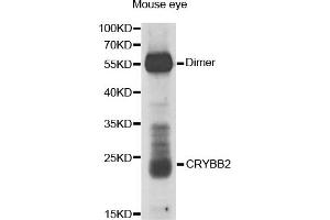 Western Blotting (WB) image for anti-Crystallin, beta B2 (CRYbB2) antibody (ABIN1876777) (CRYbB2 抗体)
