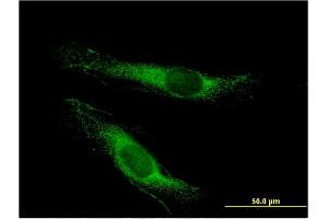Immunofluorescence of monoclonal antibody to LSS on HeLa cell. (LSS 抗体  (AA 633-732))