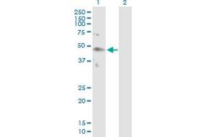 Western Blot analysis of KIR2DL4 expression in transfected 293T cell line by KIR2DL4 MaxPab polyclonal antibody. (KIR2DL4/CD158d 抗体  (AA 1-377))