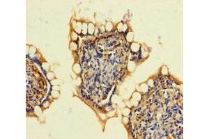 Immunohistochemistry of paraffin-embedded human small intestine tissue using ABIN7167939 at dilution of 1:100 (ARHGAP19 抗体  (AA 1-494))