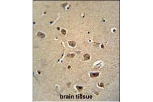 RAT SERPH Monoclonal Antibody (Center) (ABIN658998 and ABIN2838038) immunohistochemistry analysis in formalin fixed and paraffin embedded human brain tissue followed by peroxidase conjμgation of the secondary antibody and DAB staining.