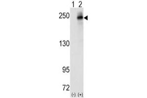 Western blot analysis of ALK antibody and 293 cell lysate (2 ug/lane) either nontransfected (Lane 1) or transiently transfected with the human gene (2). (ALK 抗体  (AA 636-666))