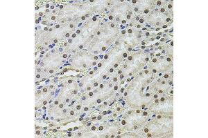 Immunohistochemistry of paraffin-embedded rat kidney using SET/T antibody (ABIN6131351, ABIN6147629, ABIN6147632 and ABIN6216153) at dilution of 1:100 (40x lens). (SET/TAF-I 抗体  (AA 146-277))