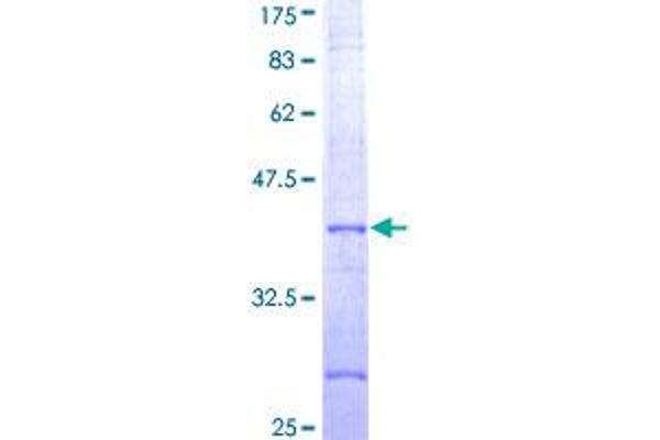 NLRP3 Protein (AA 1-100) (GST tag)